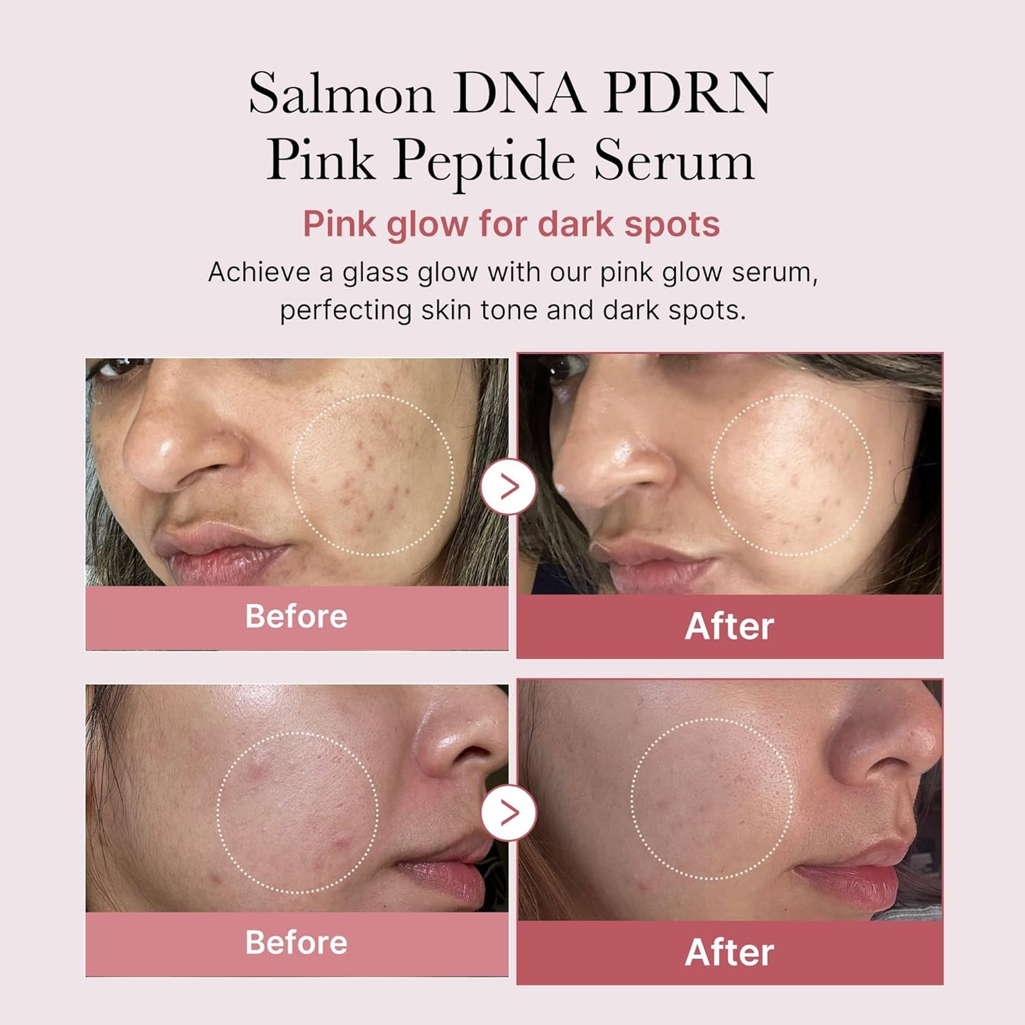 Medicube Salmon DNA PDRN Pink Peptide Serum, Pink glow serum, Peptide, Niacinamide, Hydrating & Moisturizing & Firming